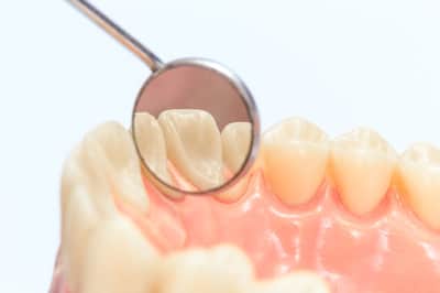 Dentures with a mirror