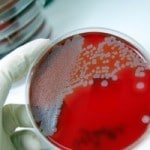 Is Crohn's Caused By An Overactive Immune System?