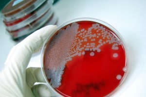 Is Crohn's Caused By An Overactive Immune System?