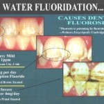 Water Fluoridation