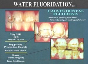 Water Fluoridation