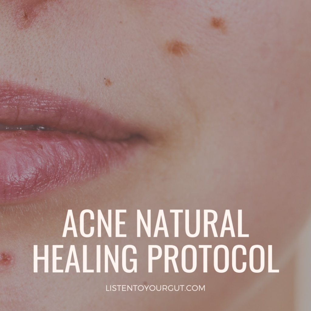 Acne Natural Healing Protocol