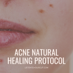 Acne Natural Healing Protocol