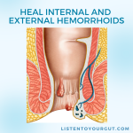 Heal Internal and External Hemorrhoids
