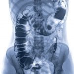 intestine