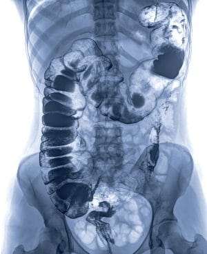 intestine