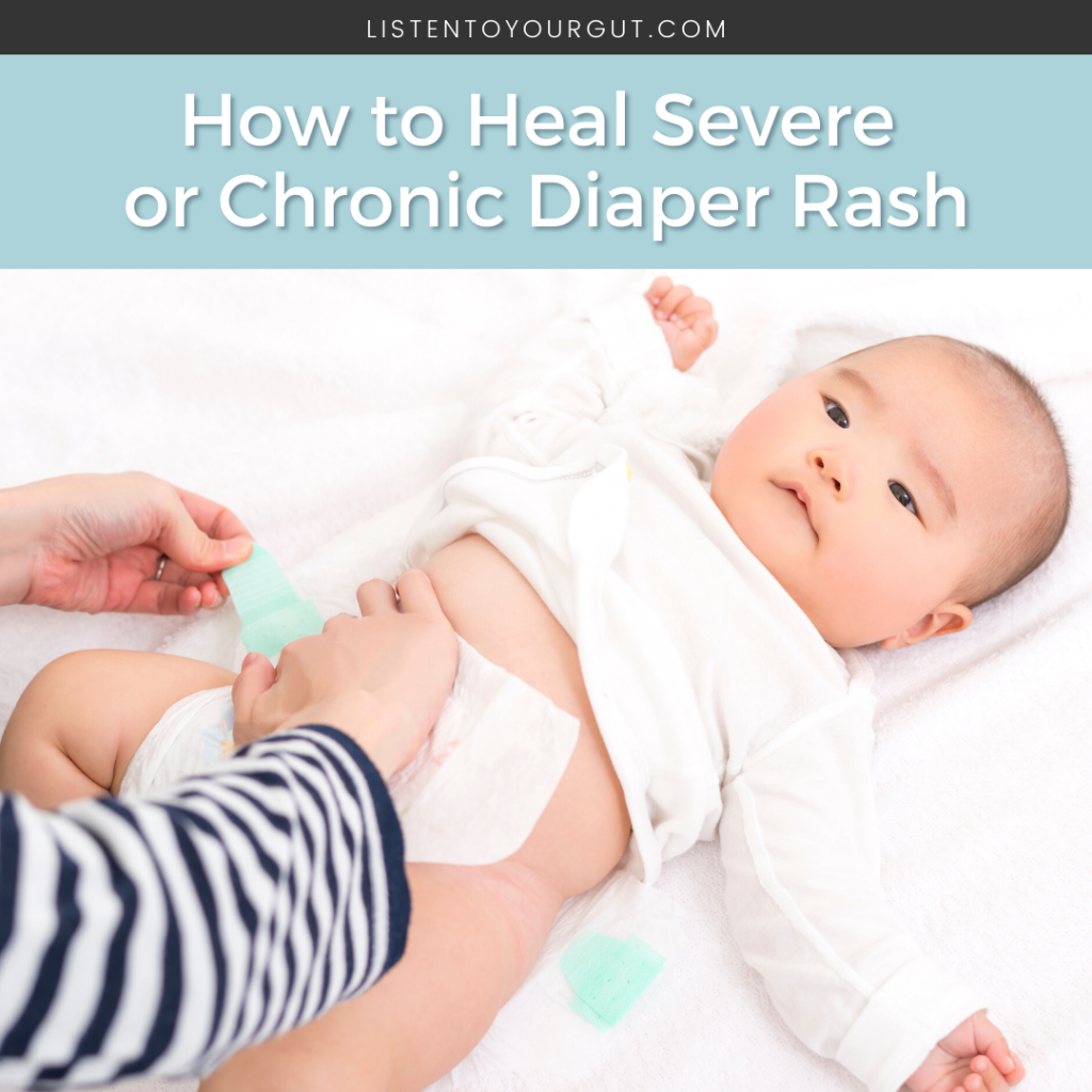 How to Heal Severe or Chronic Diaper Rash