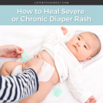 How to Heal Severe or Chronic Diaper Rash
