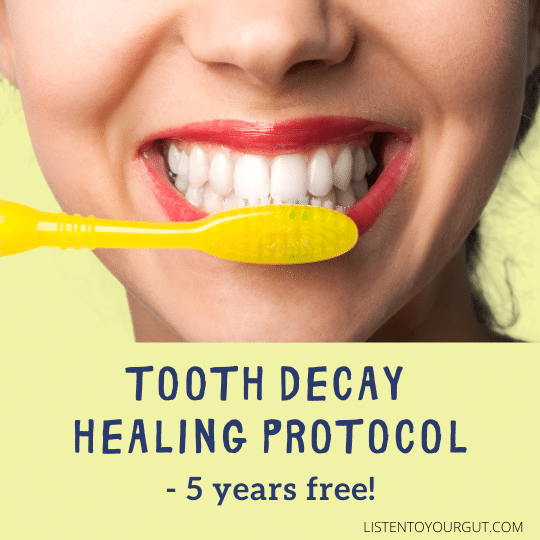 Tooth Decay Healing Protocol - 5 Years Clear!